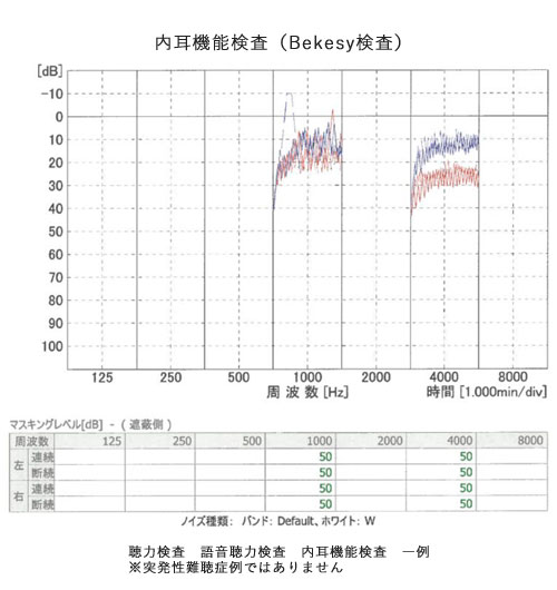 内耳機能検査