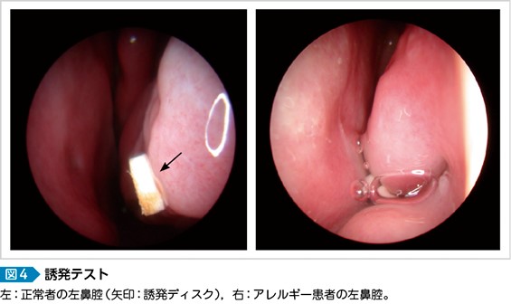 誘発テストの手法