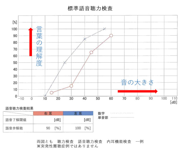 標準純音聴力検査