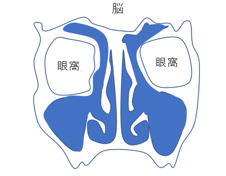 副鼻腔炎 蓄膿症 の手術なら横浜市の石井耳鼻咽喉科診療所へ