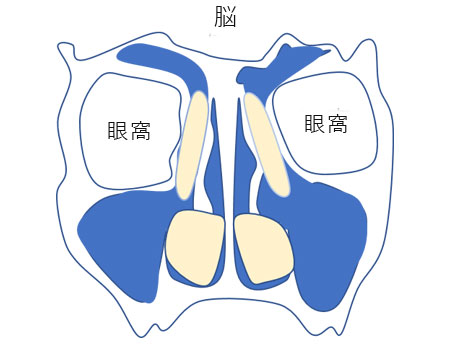 副鼻腔炎 蓄膿症 の手術なら横浜市の石井耳鼻咽喉科診療所へ