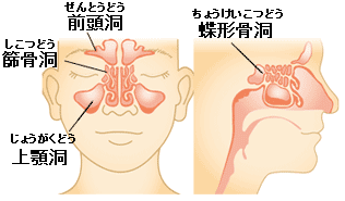 副鼻腔（蓄膿症）