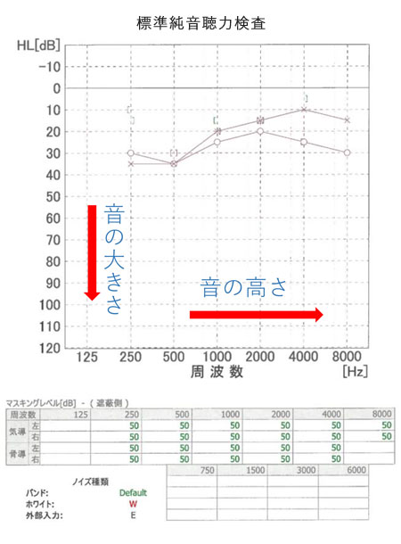 標準純音聴力検査